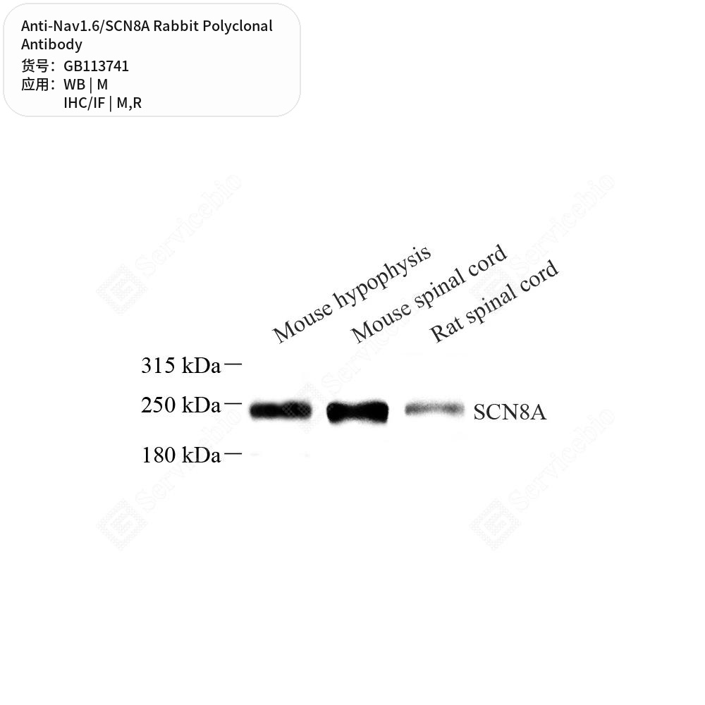 Антитела первичные, поликлональные кролика к Nav1.6/SCN8A крысы, мыши, 50 мкл