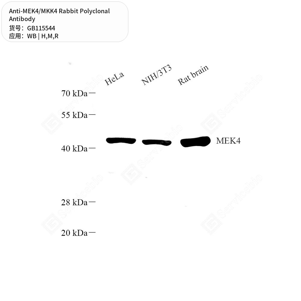 Антитела первичные, поликлональные кролика к MEK4/MKK4 крысы, мыши, человека, 50 мкл