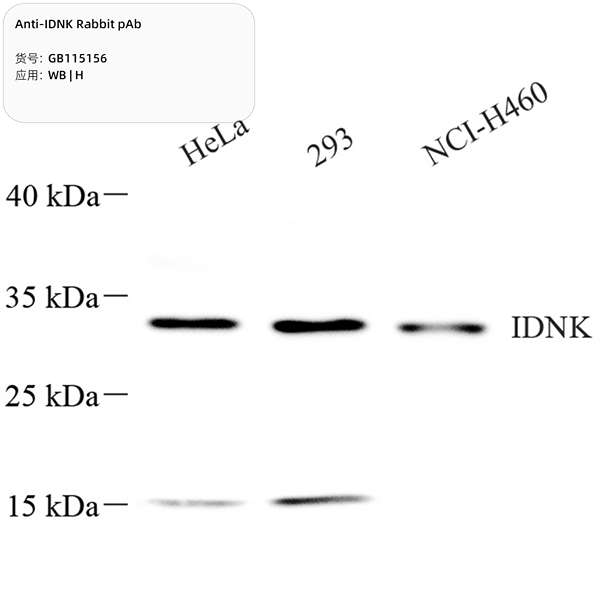 Антитела первичные, поликлональные, IDNK, 100 мкл