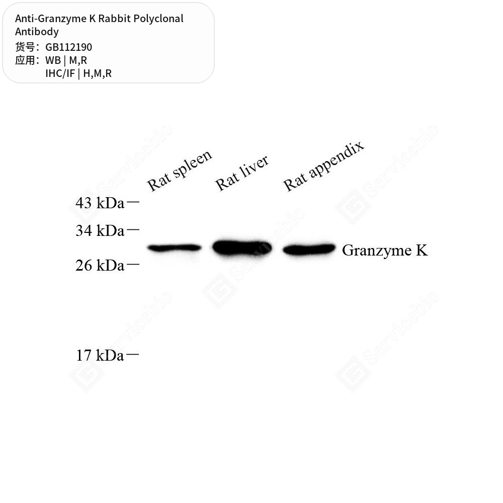 Антитела первичные, поликлональные кролика к Granzyme K крысы, мыши, человека, 100 мкл