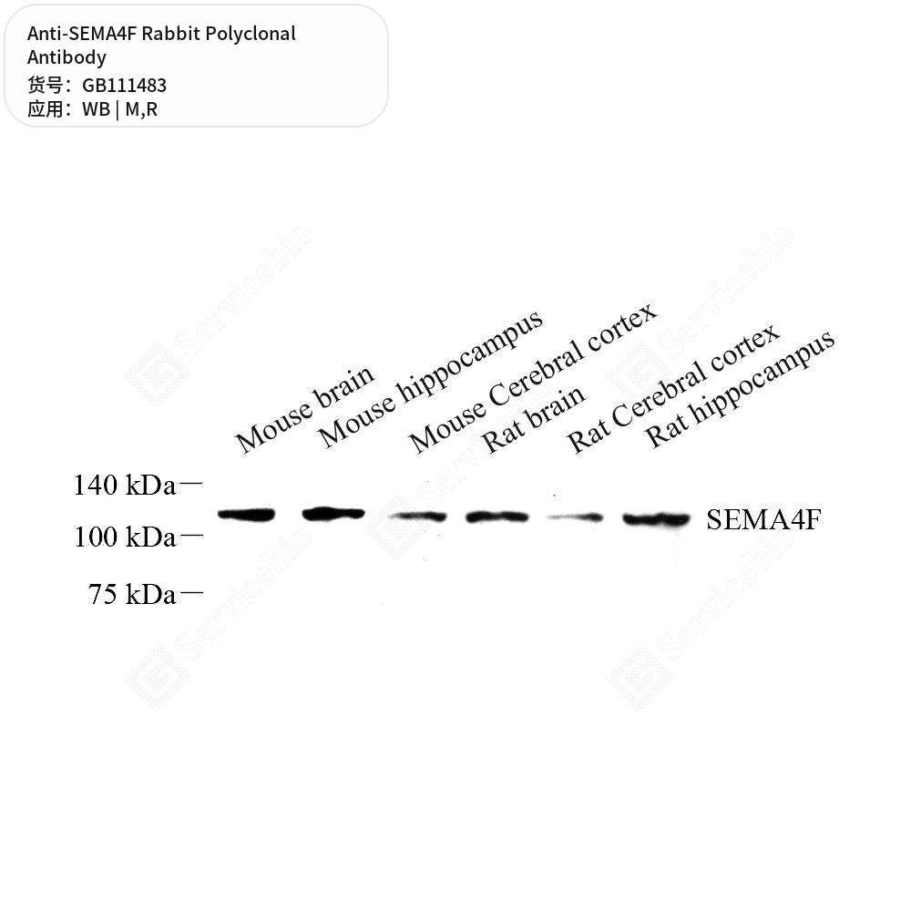 Антитела первичные, поликлональные кролика к SEMA4F крысы, мыши, 100 мкл