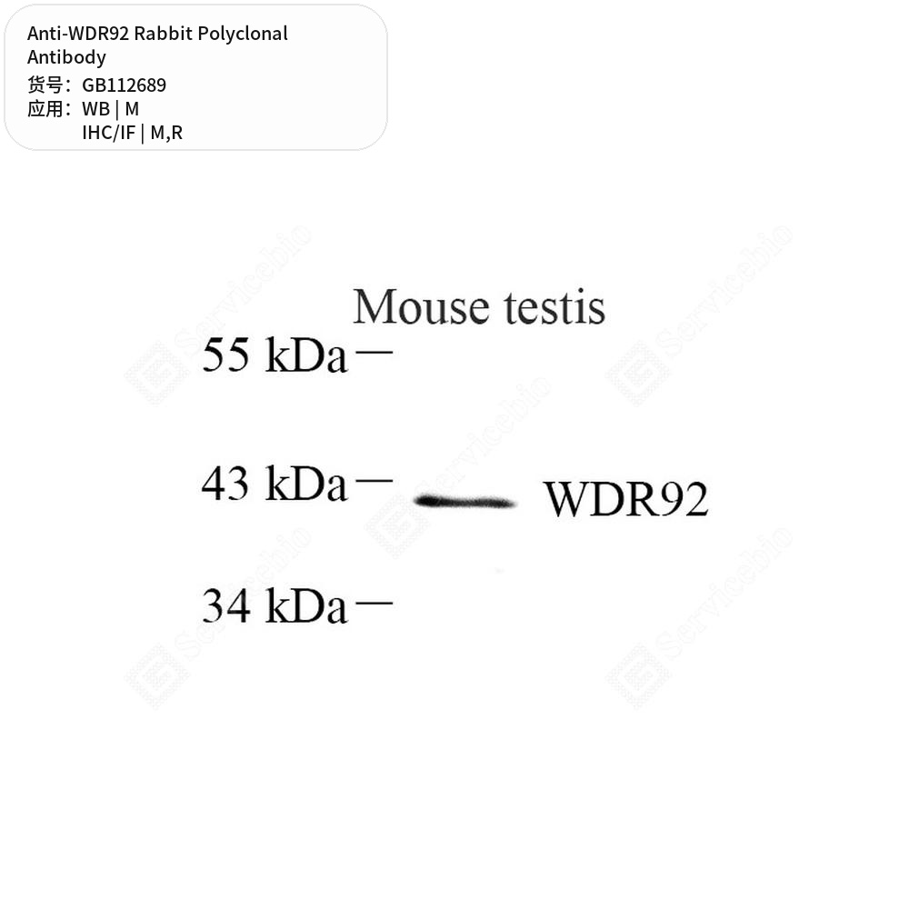 Антитела первичные, поликлональные кролика к WDR92 крысы, мыши, 100 мкл