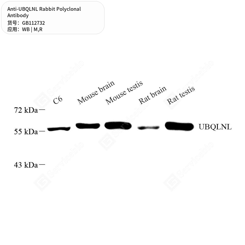 Антитела первичные, поликлональные кролика к UBQLNL крысы, мыши, 50 мкл