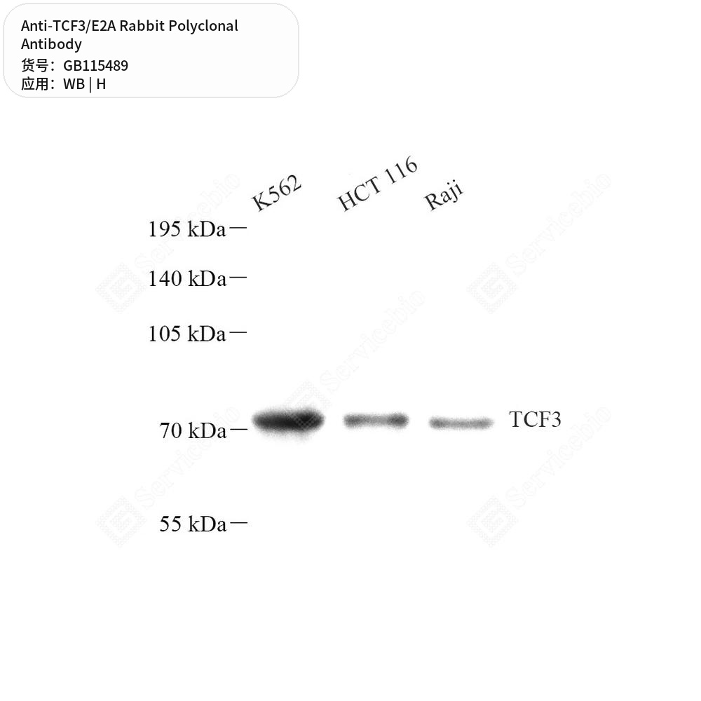 Антитела первичные, поликлональные кролика к TCF3/E2A человека, 100 мкл