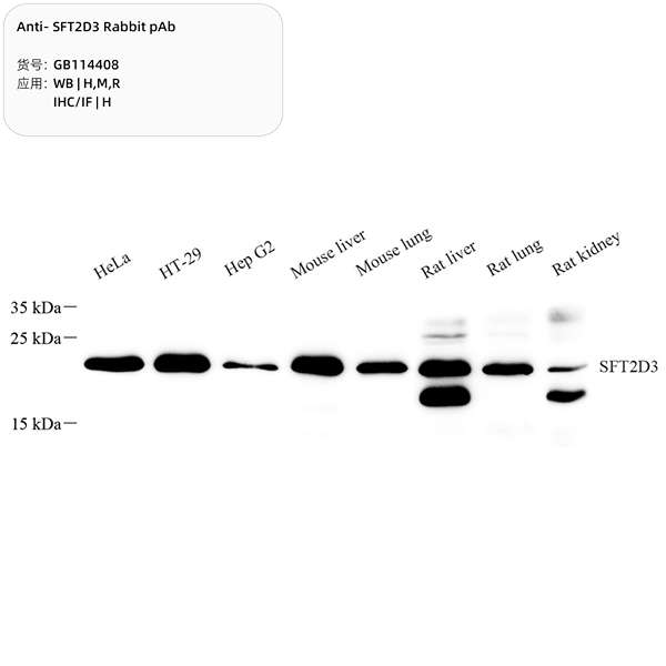 Антитела первичные, поликлональные, SFT2D3, 100 мкл
