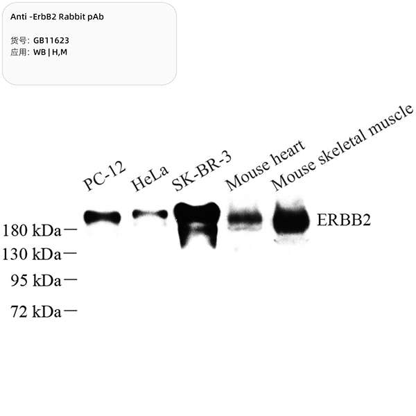 Антитела первичные, поликлональные, ErbB2, 100 мкл
