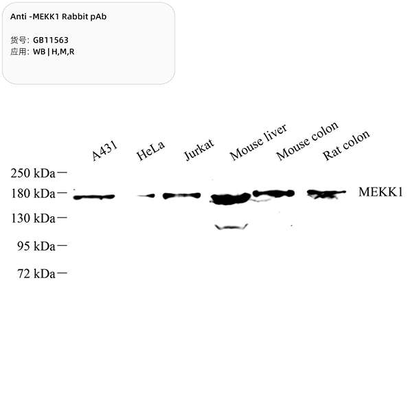 Антитела первичные, поликлональные, MEKK1, 100 мкл