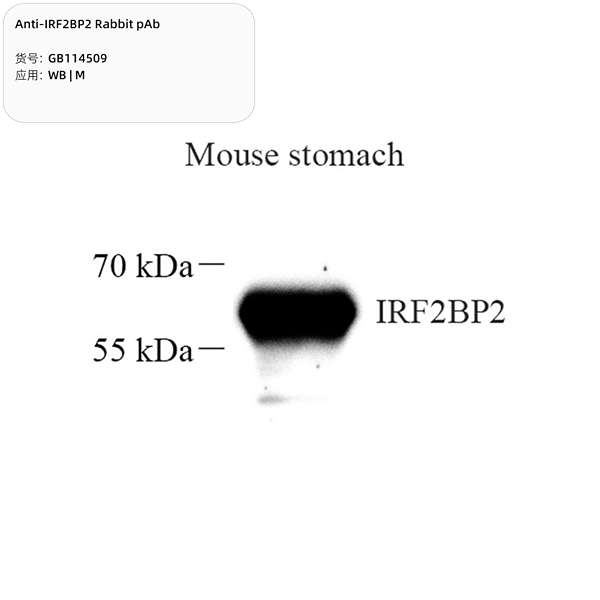 Антитела первичные, поликлональные, IRF2BP2, 100 мкл