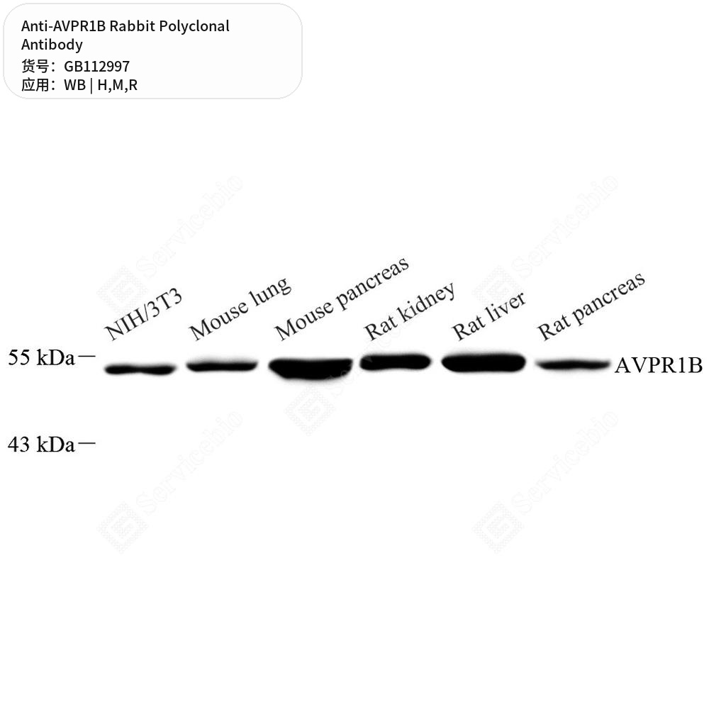 Антитела первичные, поликлональные кролика к AVPR1B крысы, мыши, человека, 50 мкл