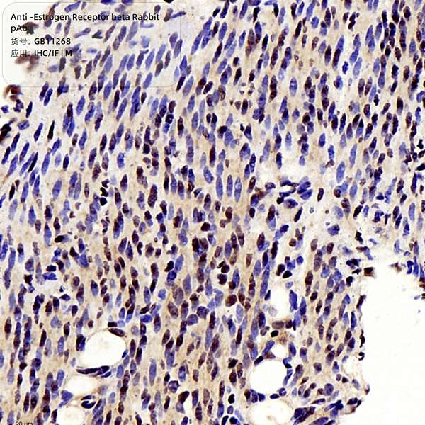 Антитела первичные, поликлональные, Estrogen Receptor beta, 100 мкл