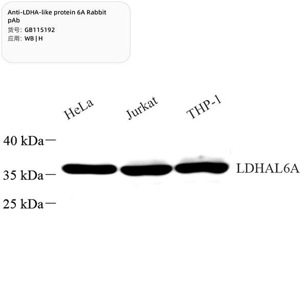 Антитела первичные, поликлональные, LDHA-like protein 6A, 100 мкл