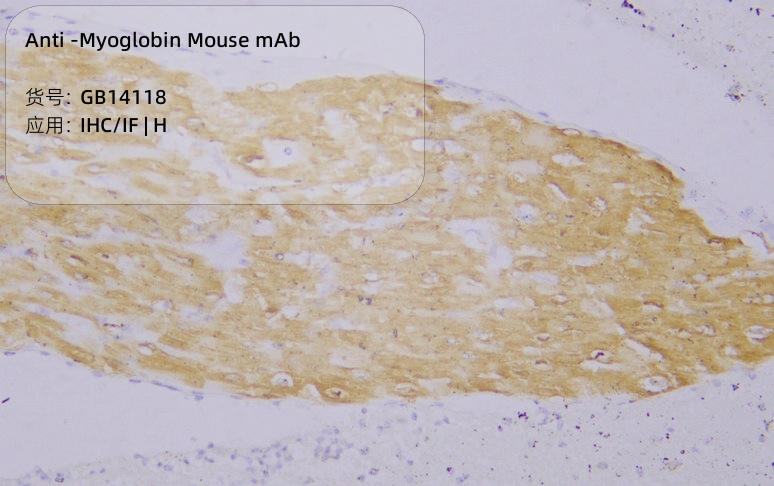 Антитела первичные, моноклональные мыши к Myoglobin человека, 50 мкл