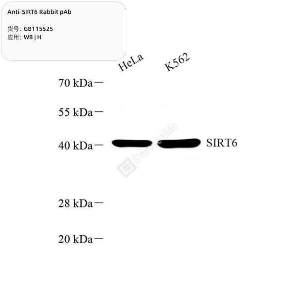 Антитела первичные, поликлональные, SIRT6, 100 мкл