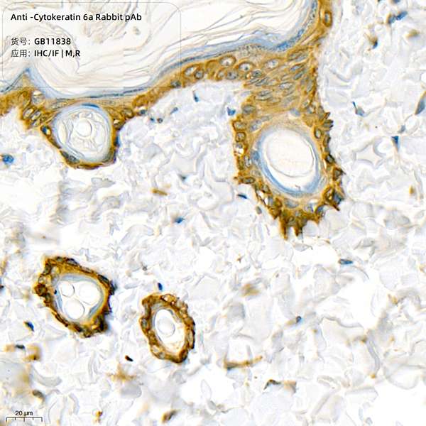 Антитела первичные, поликлональные, Cytokeratin 6a, 100 мкл