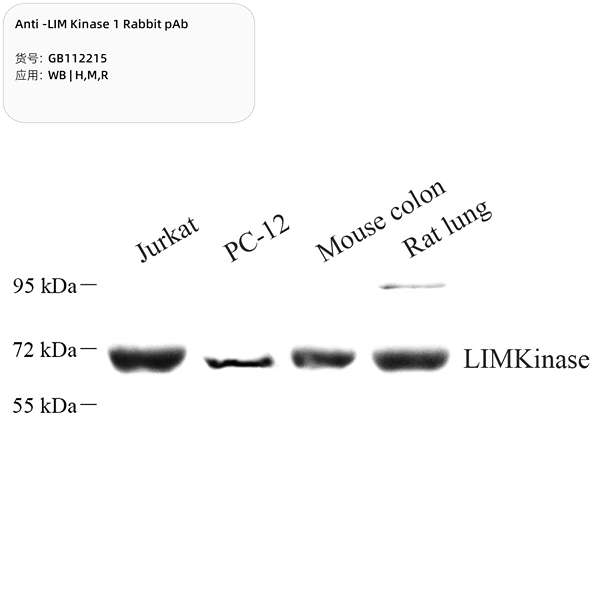 Антитела первичные, поликлональные, LIM Kinase 1, 100 мкл