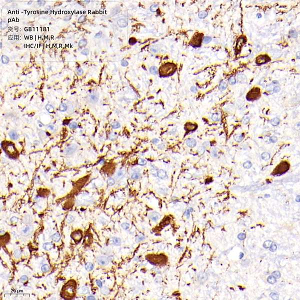 Антитела первичные, поликлональные Tyrosine Hydroxylase, 100 мкл