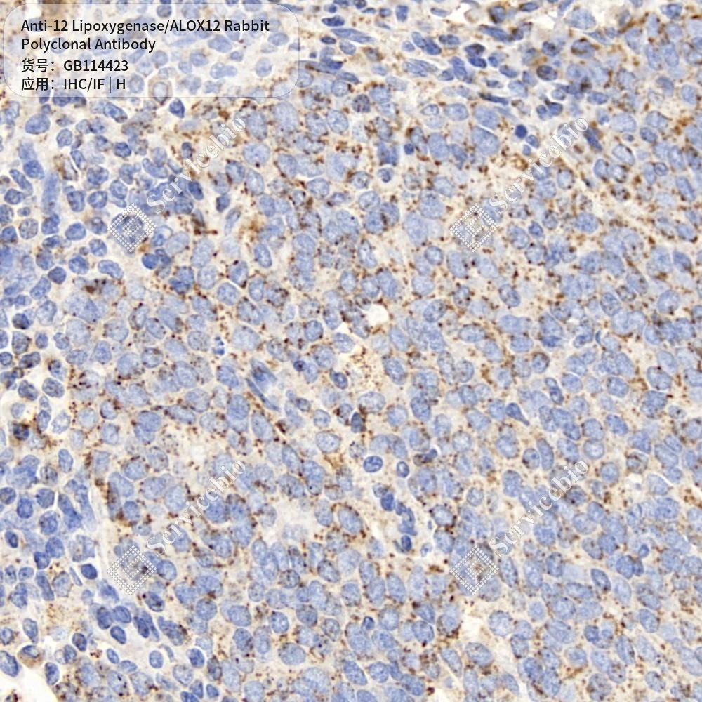 Антитела первичные, поликлональные кролика к 12 Lipoxygenase/ALOX12 человека, 100 мкл