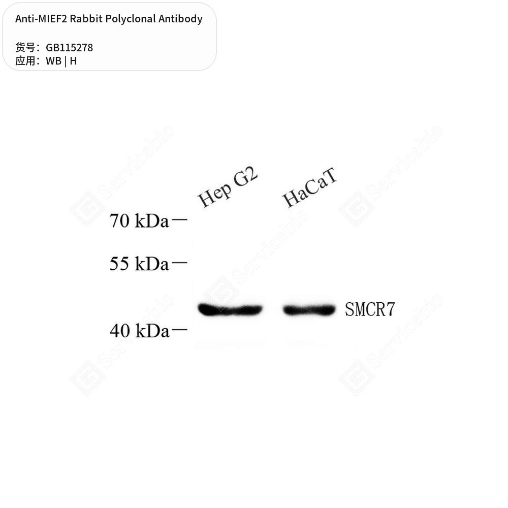 Антитела первичные, поликлональные кролика к MIEF2 человека, 100 мкл