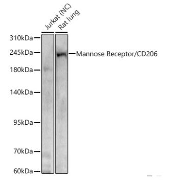 Антитела первичные, поликл. кролика к Mannose Receptor/CD206 человека, мыши, крысы, 100 м
