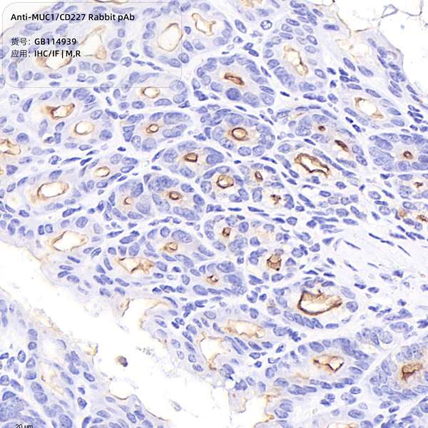 Антитела первичные, поликлональные, MUC1/CD227, 100 мкл