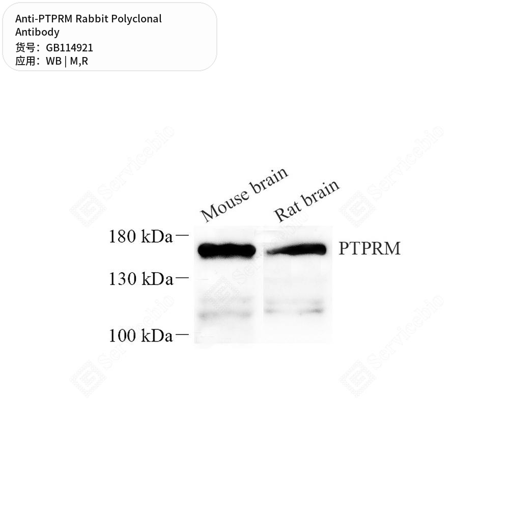 Антитела первичные, поликлональные кролика к PTPRM крысы, мыши, 100 мкл