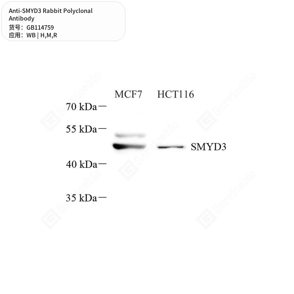 Антитела первичные, поликлональные кролика к SMYD3 крысы, мыши, человека, 50 мкл