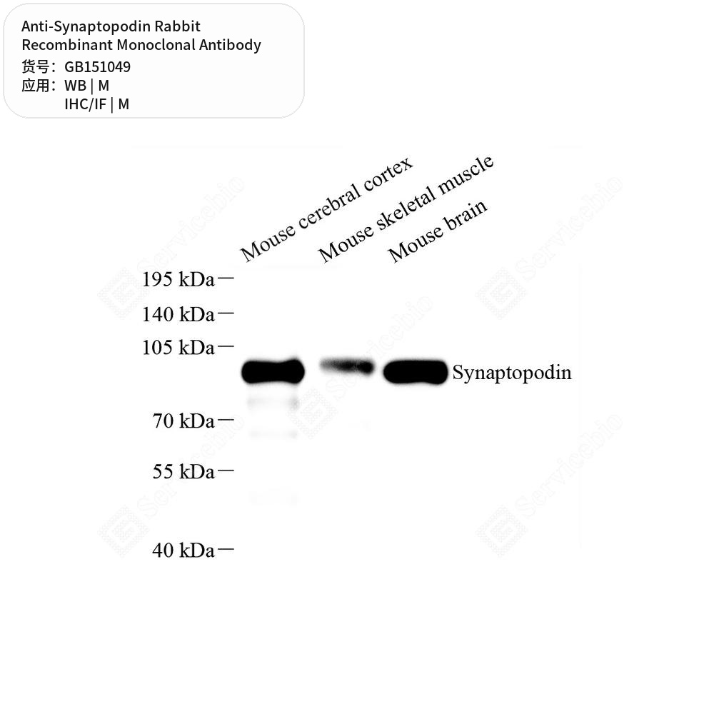 Антитела первичные, моноклональные кролика к Synaptopodin мыши, 100 мкл