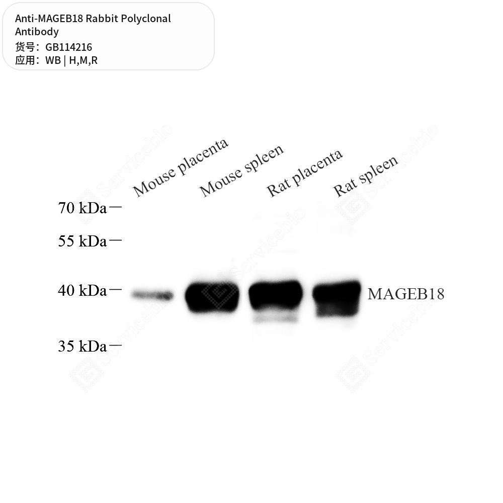 Антитела первичные, поликлональные кролика к MAGEB18 крысы, мыши, человека, 50 мкл