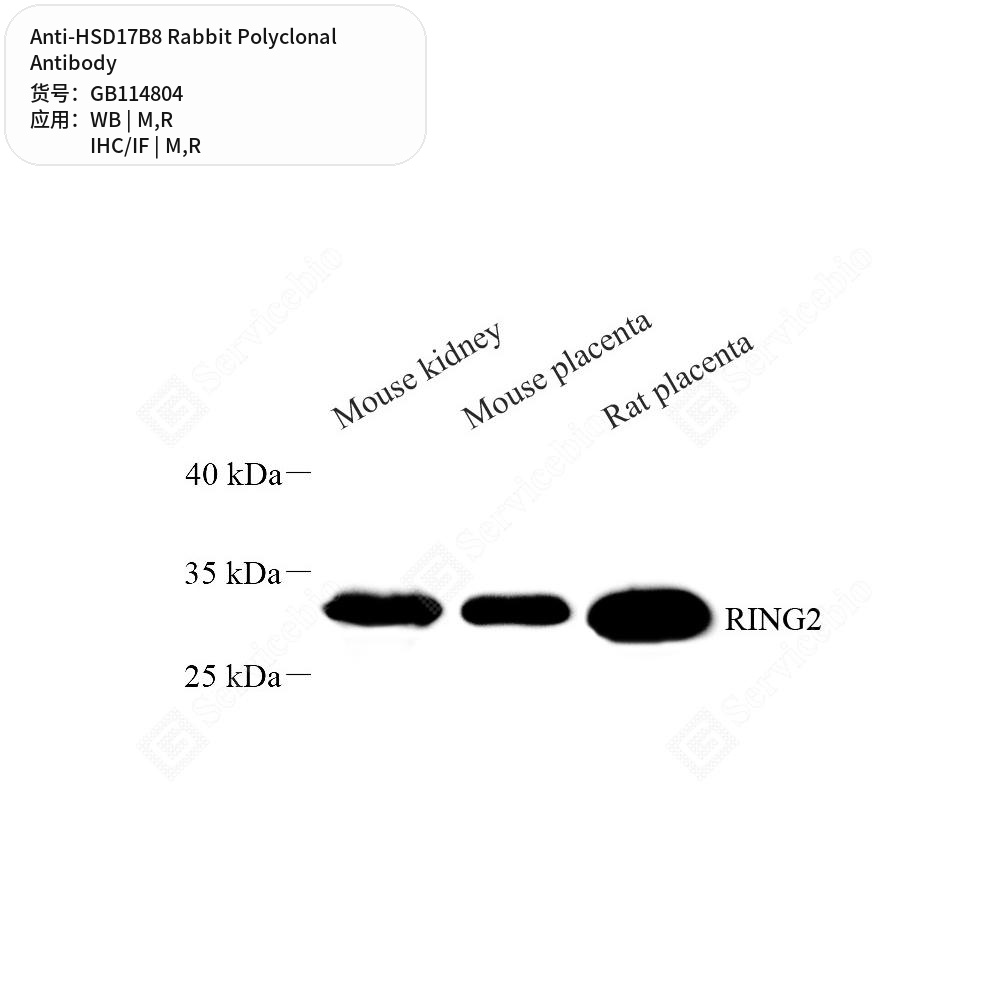 Антитела первичные, поликлональные кролика к HSD17B8 крысы, мыши, 100 мкл