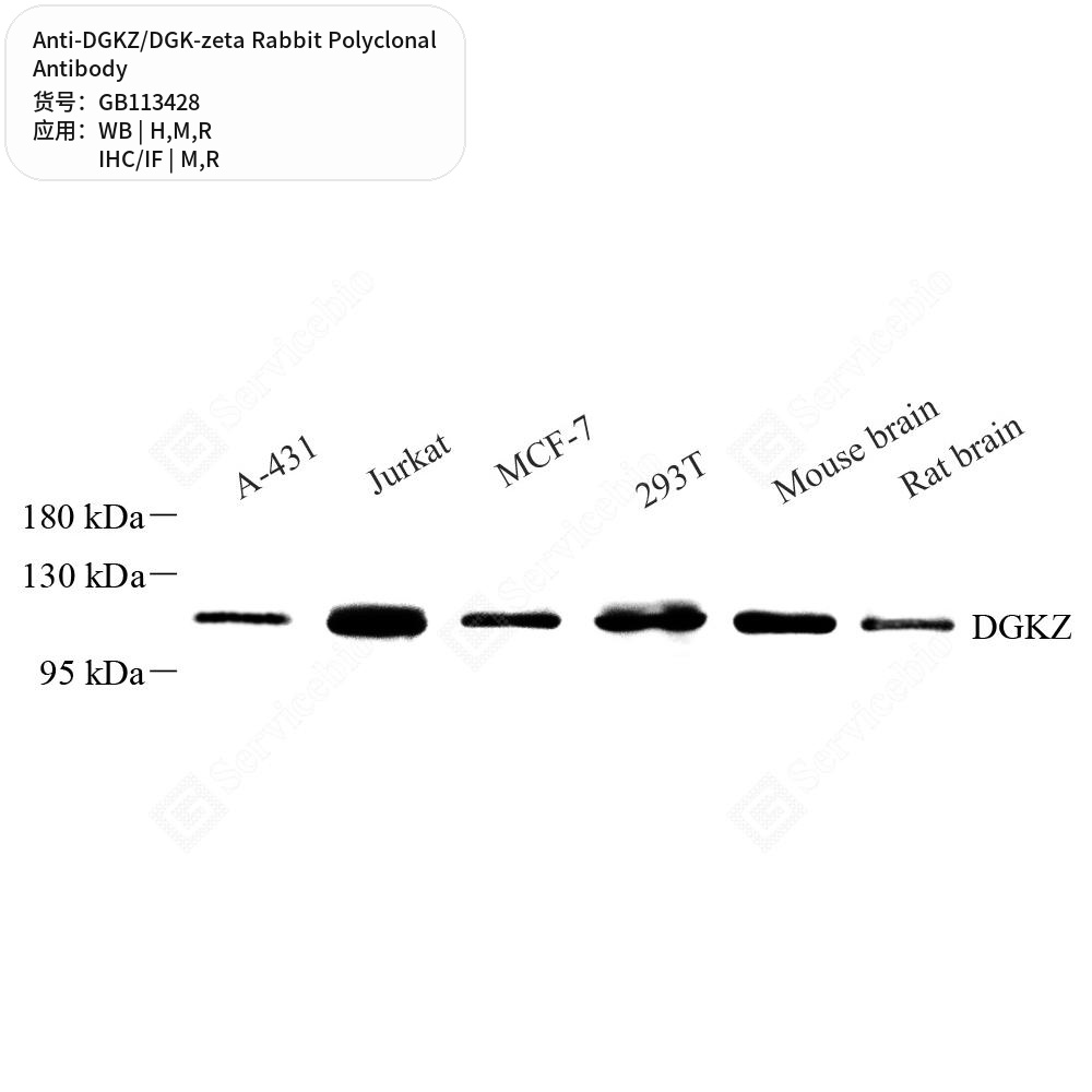 Антитела первичные, поликлональные кролика к DGKZ/DGK-zeta крысы, мыши, человека, 100 мкл