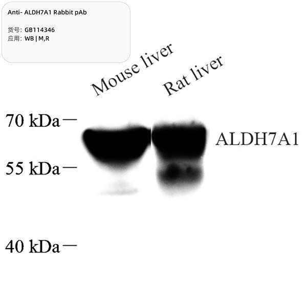 Антитела первичные, поликлональные, ALDH7A1, 100 мкл