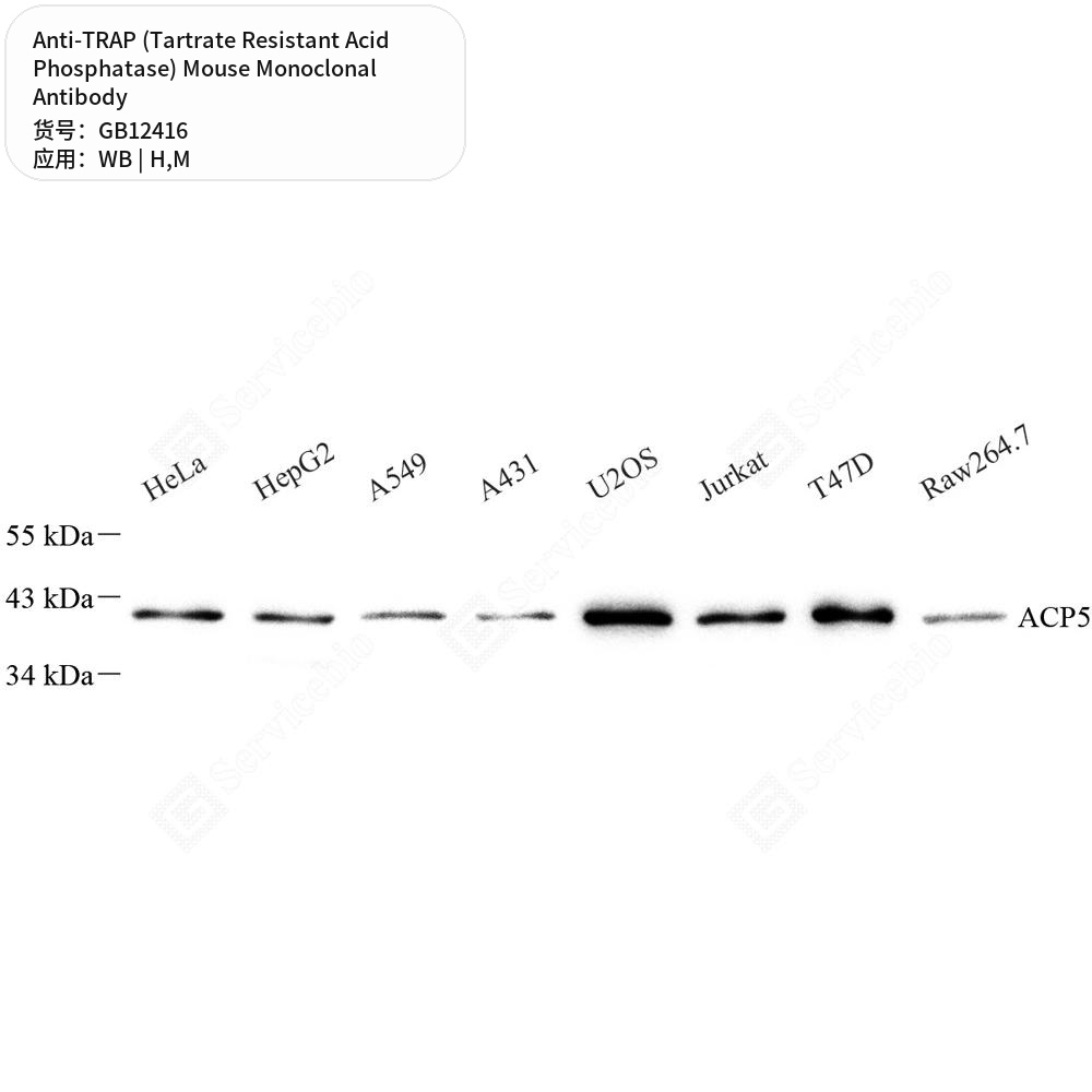 Антитела первичные, монок. мыши к TRAP (Tartrate Resistant Acid Phosphatase) мыши, чел., 50 мкл