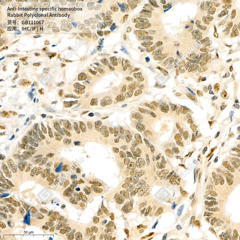 Антитела первичные, поликлональные кролика к Intestine specific homeobox человека, 100 мкл
