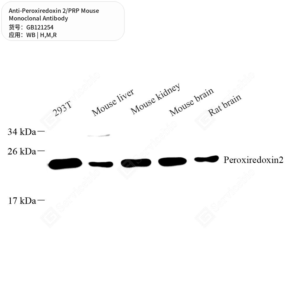 Антитела первичные, моноклональные мыши к Peroxiredoxin 2/PRP крысы, мыши, человека, 50 мкл