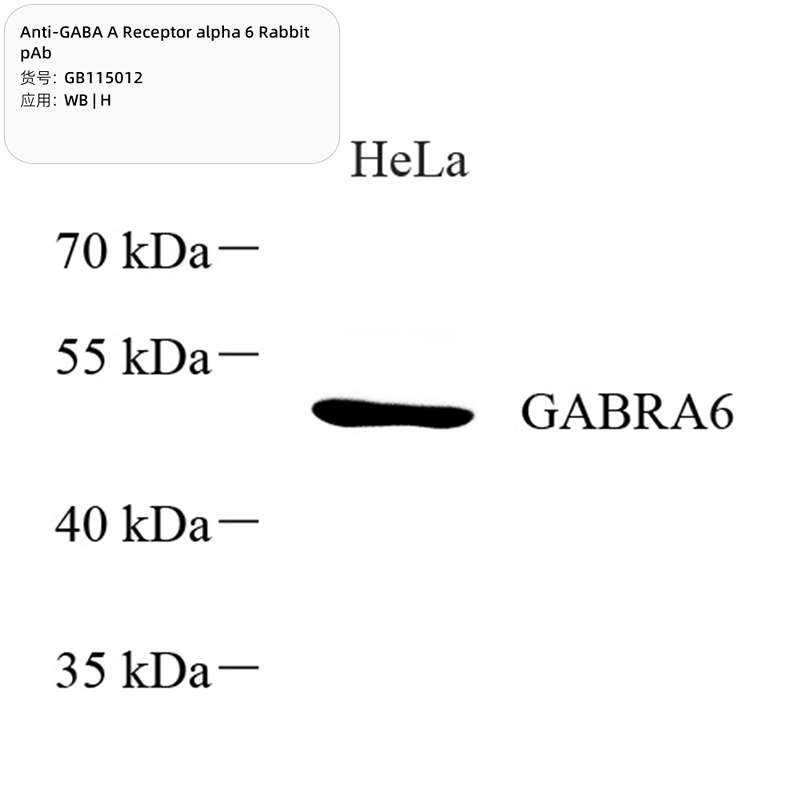 Антитела первичные, поликлональные, GABA A Receptor alpha 6, 100 мкл