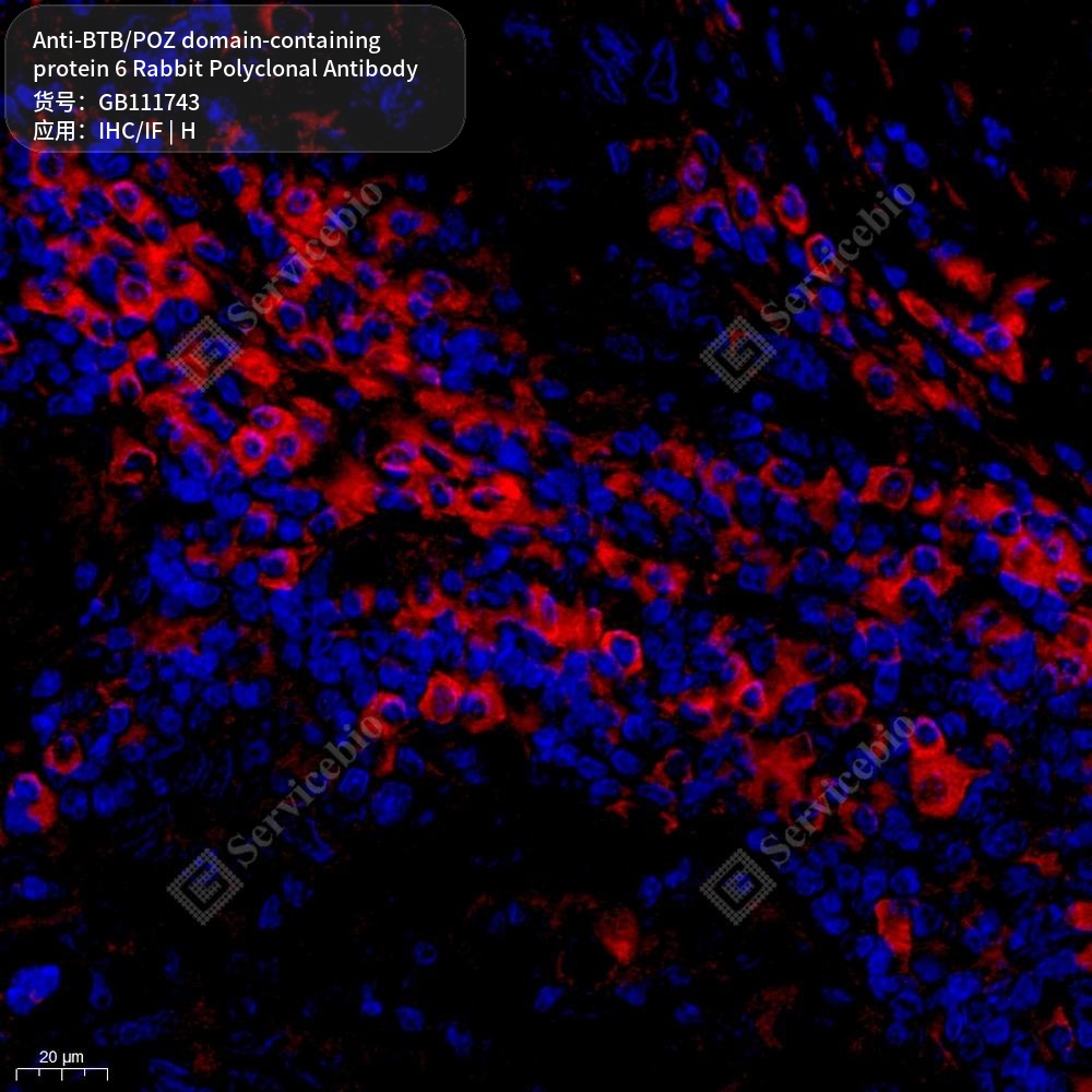 Антитела первичные, поликлональные кролика к BTB/POZ domain-containing protein 6 человека, 100 мкл