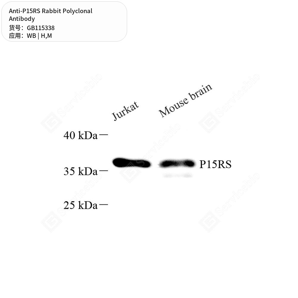 Антитела первичные, поликлональные кролика к P15RS мыши, человека, 100 мкл