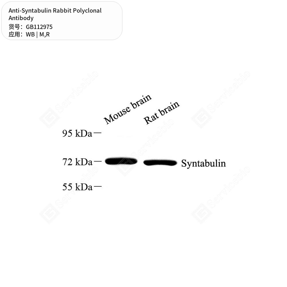 Антитела первичные, поликлональные кролика к Syntabulin крысы, мыши, 100 мкл