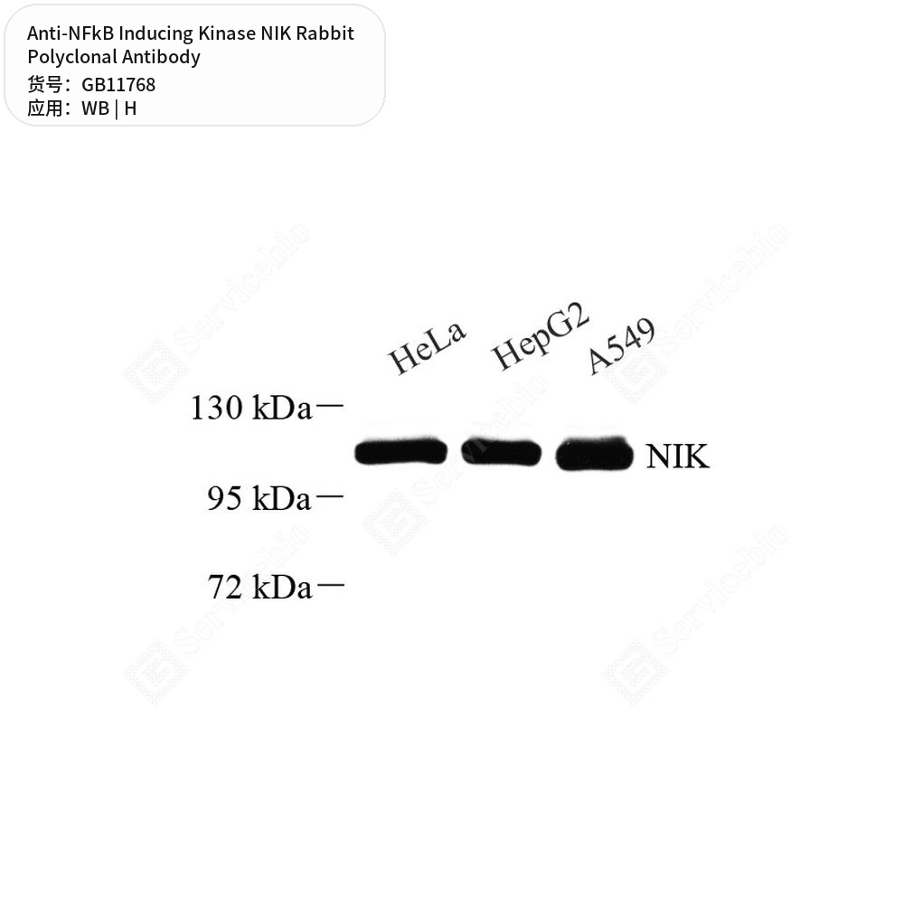 Антитела первичные, поликлональные кролика к NFkB Inducing Kinase NIK человека, 50 мкл