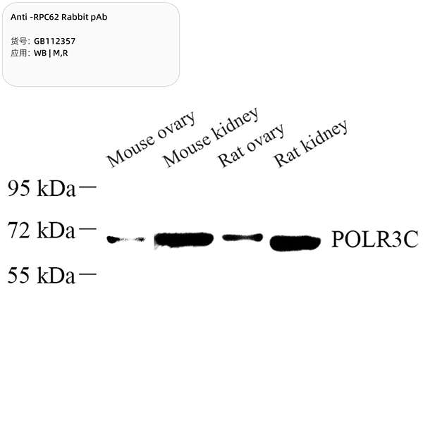 Антитела первичные, поликлональные, RPC62, 100 мкл