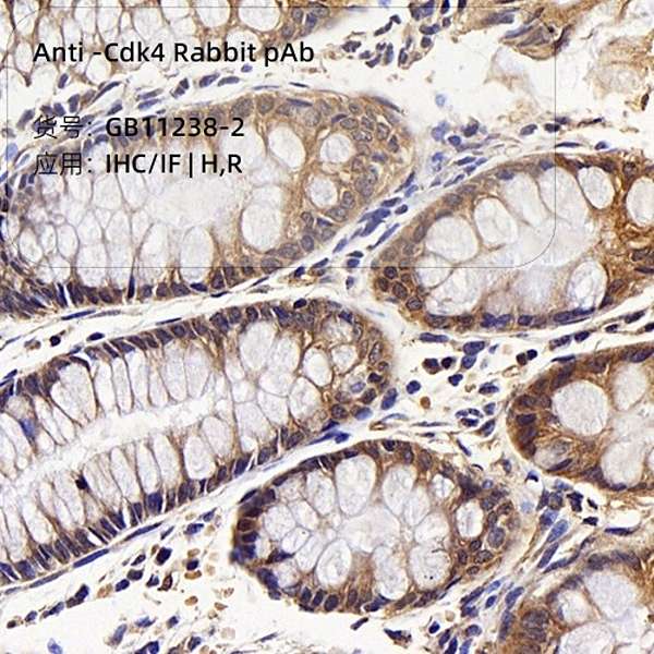 Антитела первичные, поликлональные, Cdk4, 100 мкл