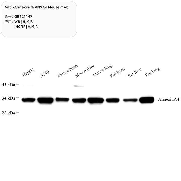 Антитела первичные, моноклональные, Annexin-4/ANXA4, 100 мкл