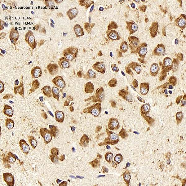 Антитела первичные, поликлональные, Neurotensin, 100 мкл