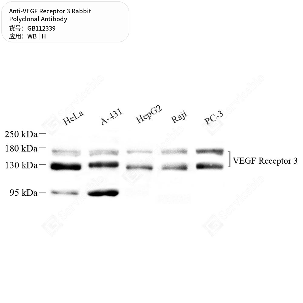 Антитела первичные, поликлональные кролика к VEGF Receptor 3 человека, 100 мкл