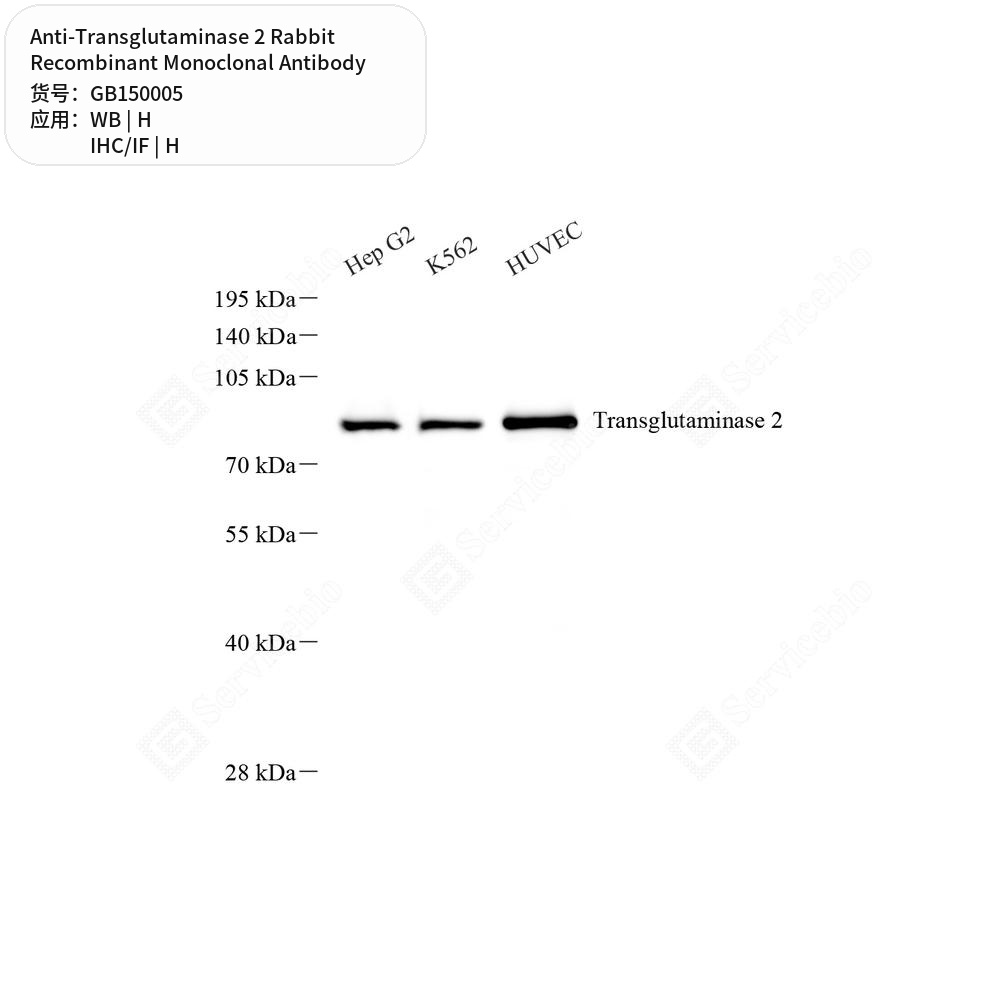 Антитела первичные, моноклональные кролика к Transglutaminase 2 человека, 50 мкл