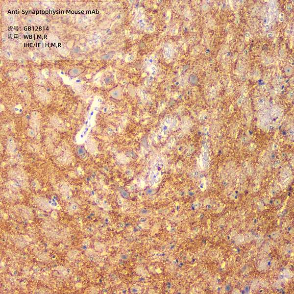 Антитела первичные, моноклональные, Synaptophysin, 100 мкл