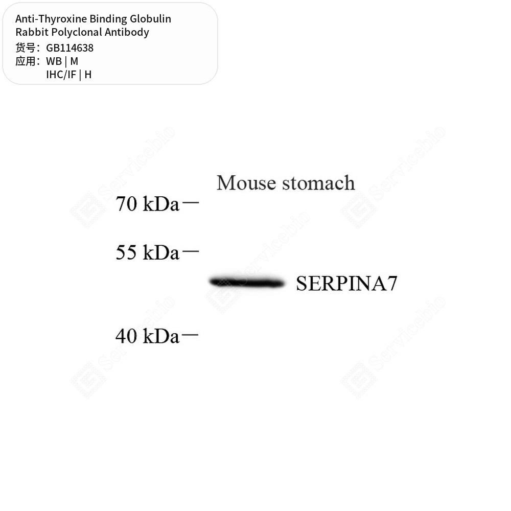 Антитела первичные, поликлональные кролика к Thyroxine Binding Globulin мыши, человека, 50 мкл