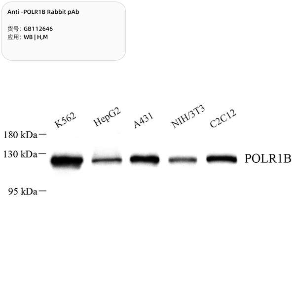 Антитела первичные, поликлональные, POLR1B, 100 мкл