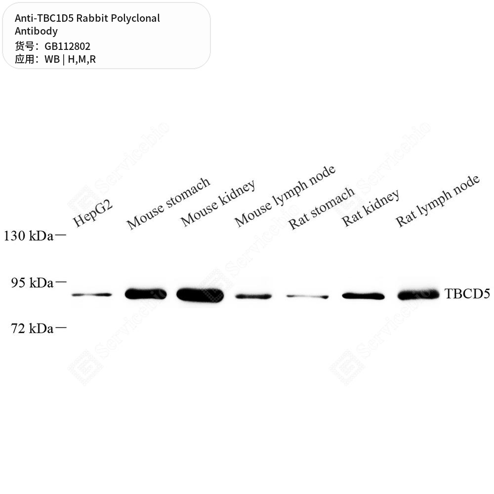 Антитела первичные, поликлональные кролика к TBC1D5 крысы, мыши, человека, 100 мкл