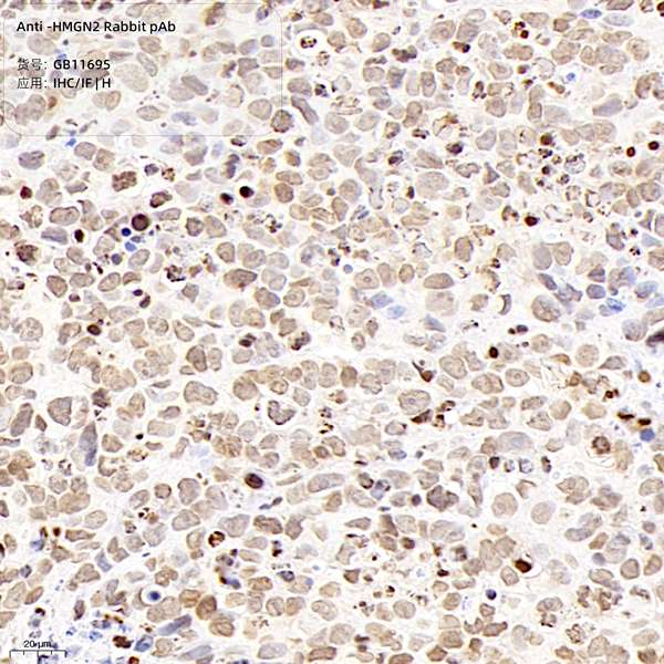 Антитела первичные, поликлональные, HMGN2, 100 мкл